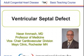 Ventricular Septal Defect (VSD)-ACHD Basic Lecture Series: Shunt Lesions: 2c